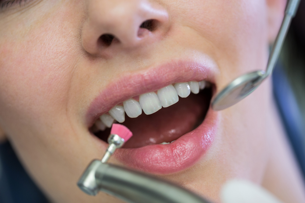 Dlaczego warto regularnie przeprowadzać zabiegi higienizacji w gabinecie stomatologicznym?